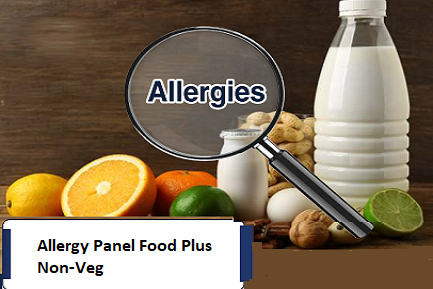 Food Allergy Test Packages in Chennai